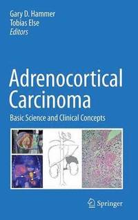 bokomslag Adrenocortical Carcinoma