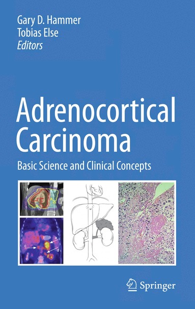 bokomslag Adrenocortical Carcinoma