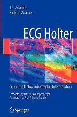 ECG Holter 1