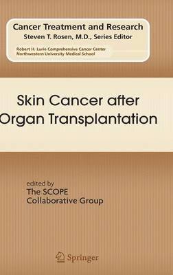 Skin Cancer after Organ Transplantation 1