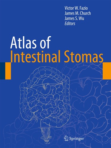 Victor W. Fazio, James M. Church, James S. Wu - Atlas of Intestinal Stomas, Inbunden