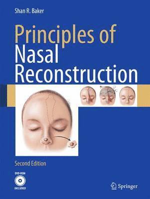 bokomslag Principles of Nasal Reconstruction