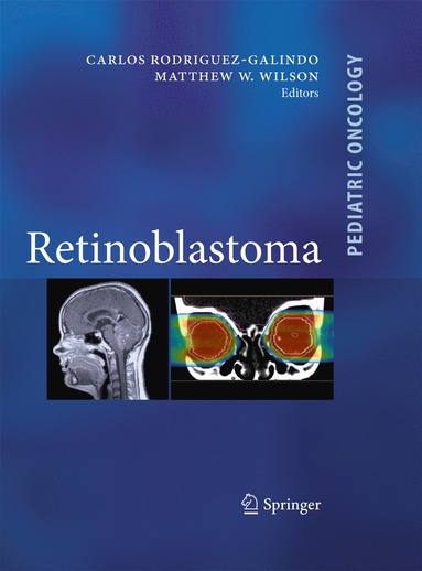 bokomslag Retinoblastoma