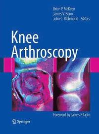 bokomslag Knee Arthroscopy