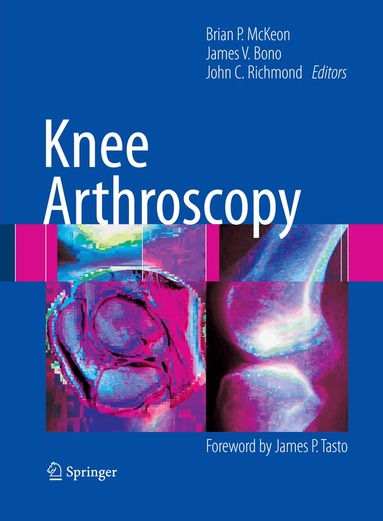 Brian P. McKeon, James V. Bono, John C. Richmond - Knee Arthroscopy, Inbunden