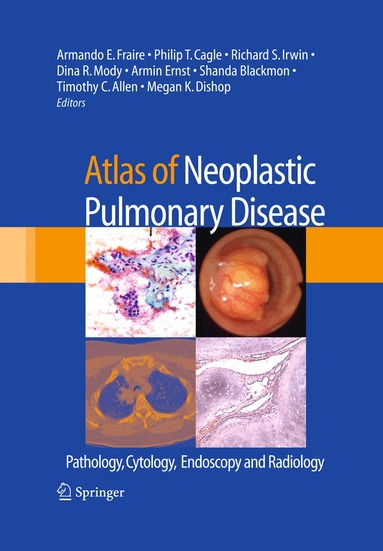 Armando E. Fraire, Philip T. Cagle, Richard S. Irwin, Dina R. Mody, Armin Ernst, Shanda Blackmon, Timothy Craig Allen, Megan K. Dishop - Atlas of Neoplastic Pulmonary Disease, Inbunden