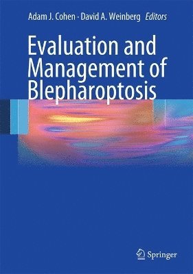 Adam J. Cohen, David A. Weinberg - Evaluation and Management of Blepharoptosis, Inbunden