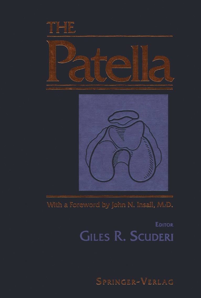 Patella