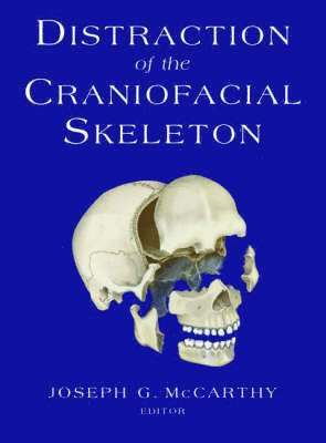 Distraction of the Craniofacial Skeleton 1