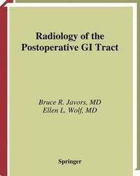 bokomslag Radiology of the Postoperative GI Tract