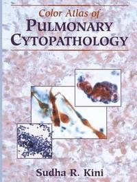 bokomslag Color Atlas of Pulmonary Cytopathology