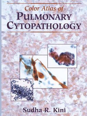 Sudha R. Kini - Color Atlas of Pulmonary Cytopathology, Inbunden