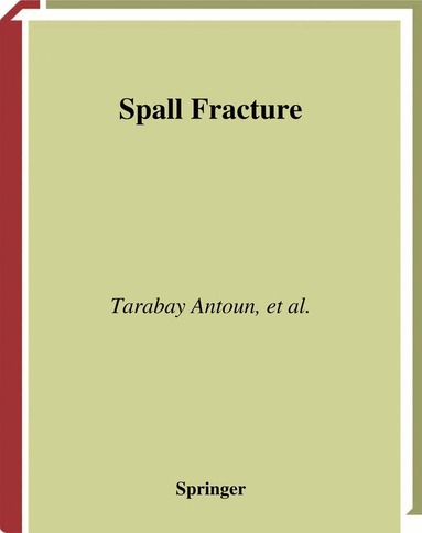 Tarabay Antoun, Lynn Seaman, Donald R Curran, Gennady I. Kanel, Sergey V. Razorenov, Alexander V. Utkin - Spall Fracture, Inbunden