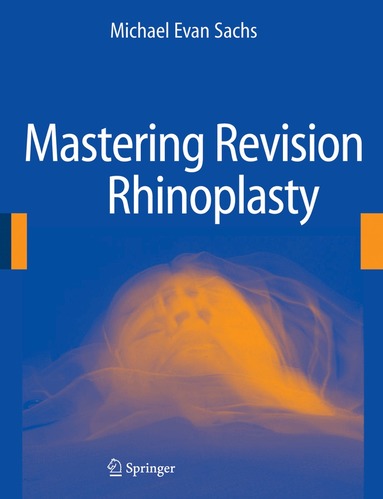 Michael Evan Sachs - Mastering Revision Rhinoplasty, Inbunden