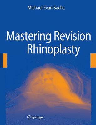 Mastering Revision Rhinoplasty 1