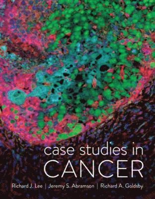 Case Studies in Cancer 1