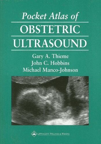 Gary A. Thieme, John C. Hobbins, Michael Manco-Johnson - Pocket Atlas of Obstetric Ultrasound, Häftad