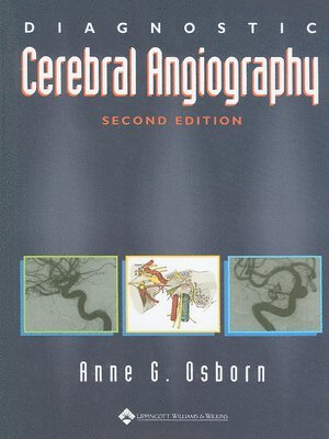 Diagnostic Cerebral Angiography 1