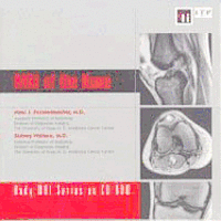 bokomslag MRI of the Knee