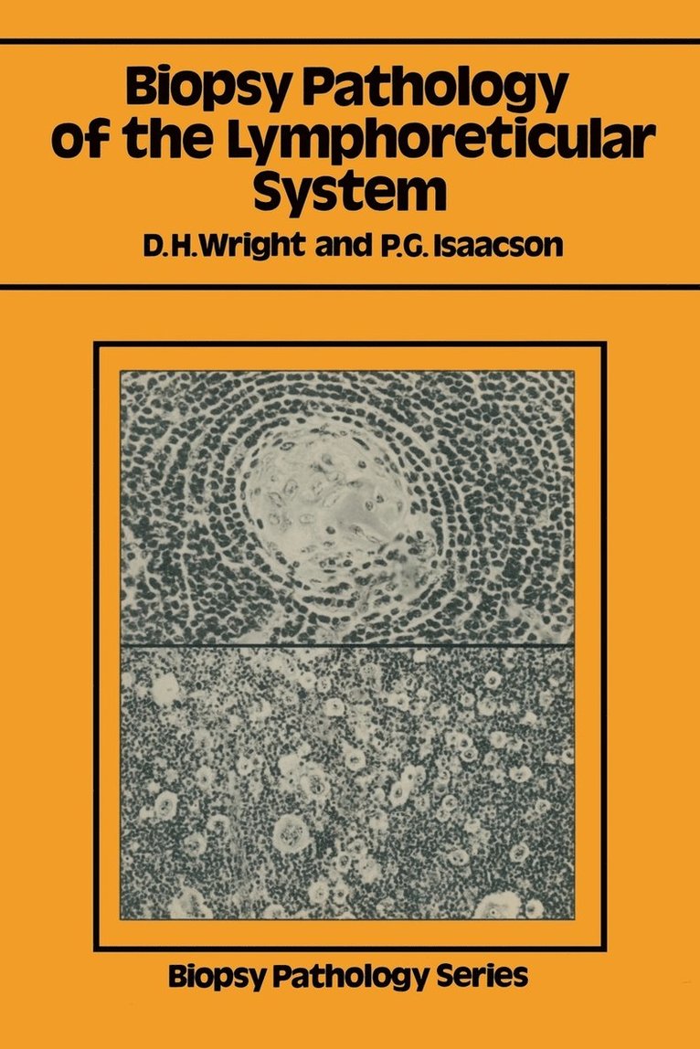 Biopsy Pathology Of The Lymphoreticular System 1