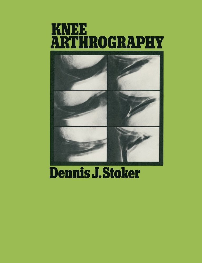 Dennis J. Stoker, Dennis J Stoker - Knee Arthrography, Häftad