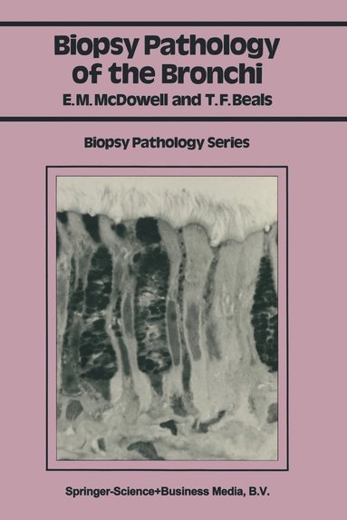 bokomslag Biopsy Pathology of the Bronchi