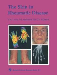 bokomslag The Skin in Rheumatic Disease