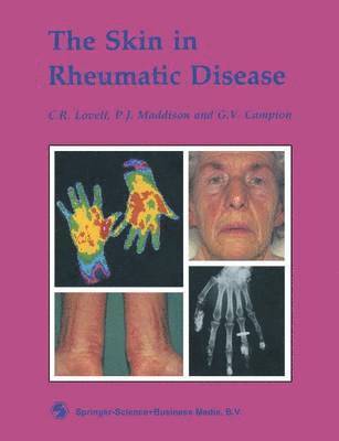 bokomslag The Skin in Rheumatic Disease