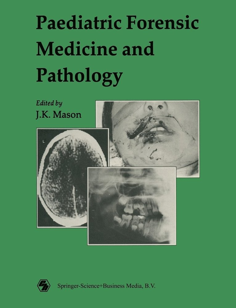 Paediatric Forensic Medicine And Pathology 1