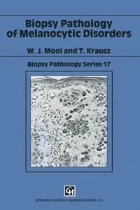 bokomslag Biopsy Pathology Of Melanocytic Disorders