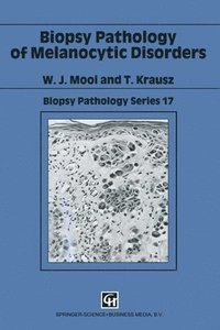 bokomslag Biopsy Pathology of Melanocytic Disorders
