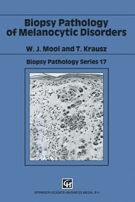 bokomslag Biopsy Pathology Of Melanocytic Disorders