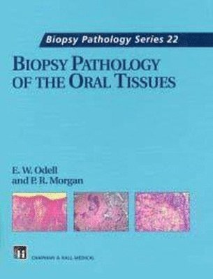 Biopsy Pathology of the Oral Tissues 1