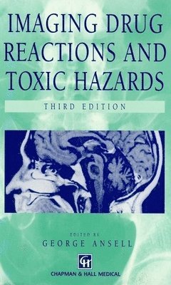 bokomslag Imaging Drug Reactions and Toxic Hazards