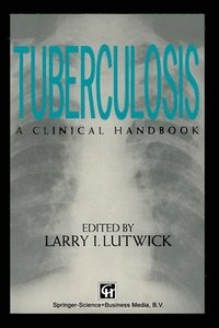 bokomslag Tuberculosis