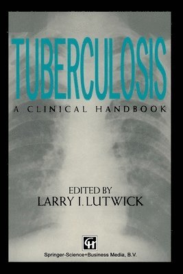 Tuberculosis 1