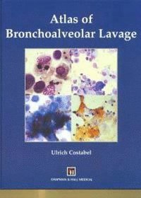 bokomslag Atlas of Bronchoalveolar Lavage