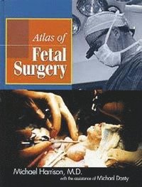 bokomslag Atlas of Fetal Surgery