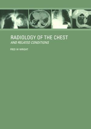 F W Wright - Radiology of the Chest and Related Conditions, Häftad