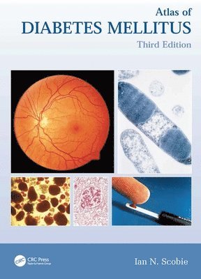 bokomslag Atlas of Diabetes Mellitus