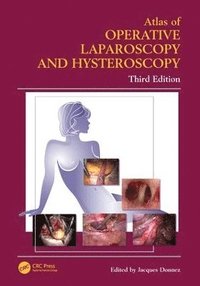 bokomslag Atlas of Operative Laparoscopy and Hysteroscopy