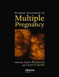 bokomslag Prenatal Assessment of Multiple Pregnancy