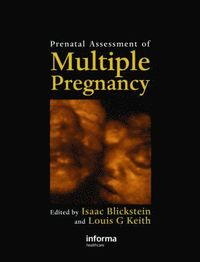 bokomslag Prenatal Assessment of Multiple Pregnancy