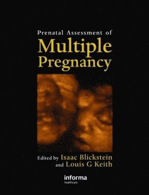 Prenatal Assessment of Multiple Pregnancy 1