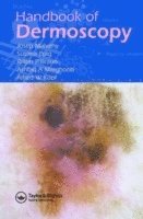 bokomslag Handbook of Dermoscopy