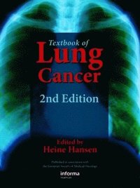 bokomslag Textbook of Lung Cancer