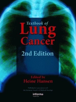 Textbook of Lung Cancer 1