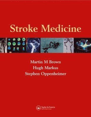 Stroke Medicine 1