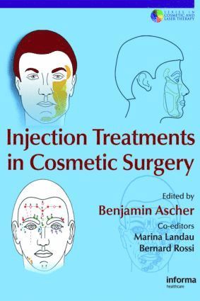 Benjamin Ascher, Marina Landau, Bernard Rossi, France) Ascher, Benjamin (Clinique Iena, Paris, France) Rossi, Bernard (Hopital Charles Nicolle, University of Rouen, Rouen - Injection Treatments in Cosmetic Surgery, Inbunden
