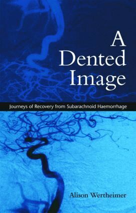 Alison Wertheimer - Dented Image, Häftad